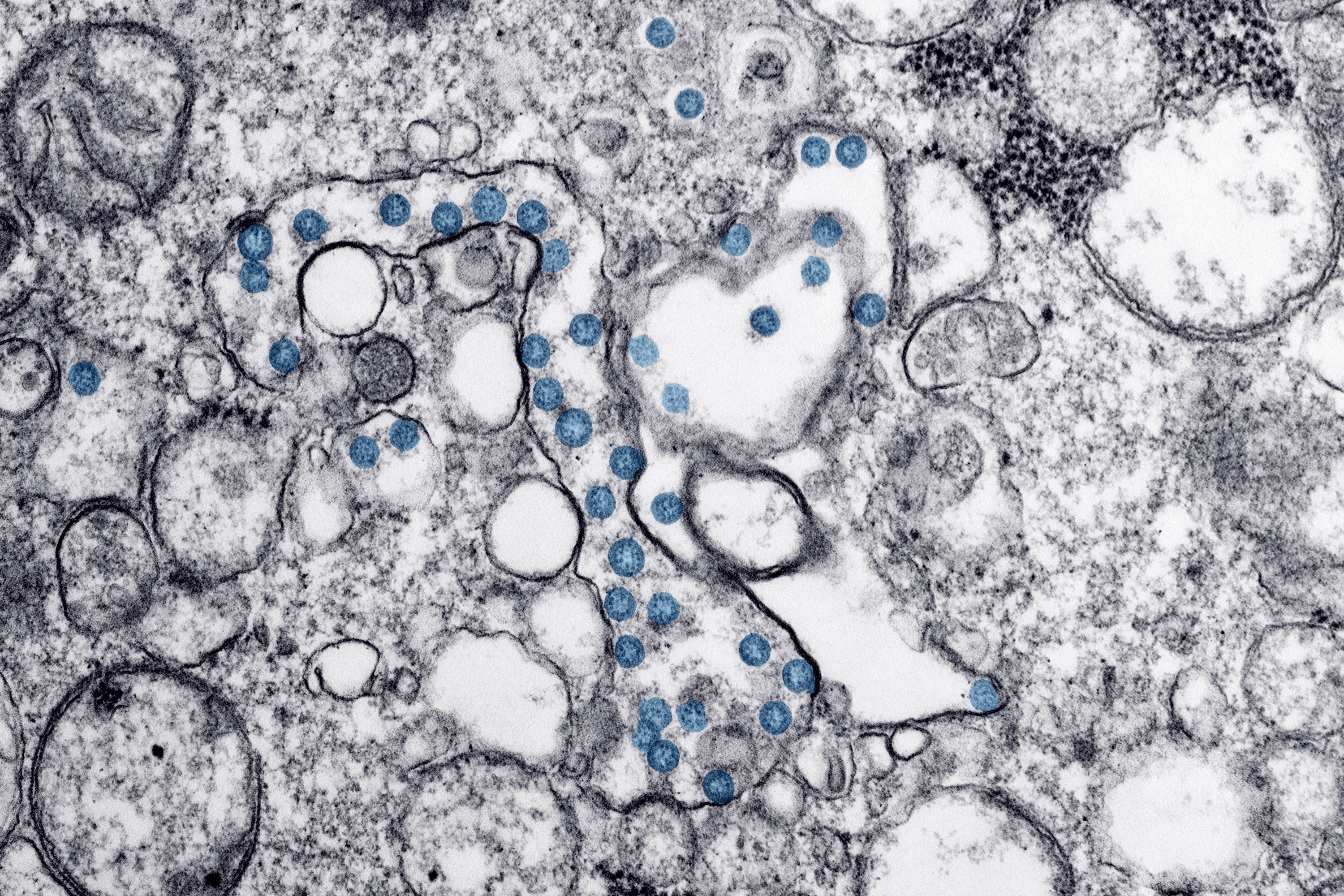 SARS-CoV-2 virus particles, in blue, imaged in an electron microscope (CDC) image.