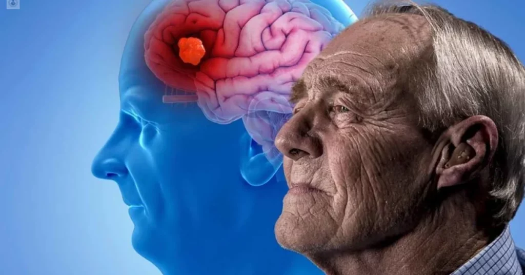 Can infection increase the risk of Alzheimer's disease?